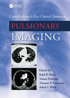 Pulmonary Imaging book