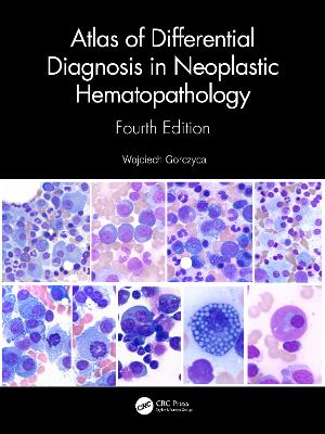 Atlas of Differential Diagnosis in Neoplastic Hematopathology book