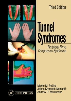 Tunnel Syndromes by Marko M. Pecina