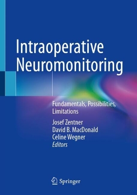 Intraoperative Neuromonitoring: Fundamentals, Possibilities, Limitations book