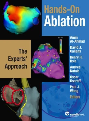 Hands-On Ablation book
