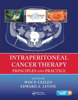 Intraperitoneal Cancer Therapy: Principles and Practice by Wim P. Ceelen