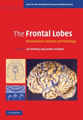 Frontal Lobes book