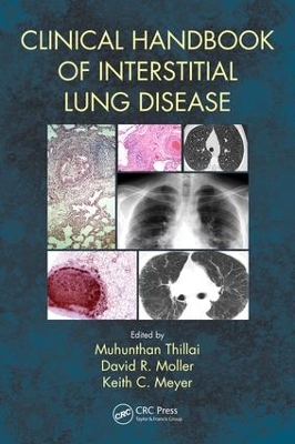 Clinical Handbook of Interstitial Lung Disease by Keith C. Meyer