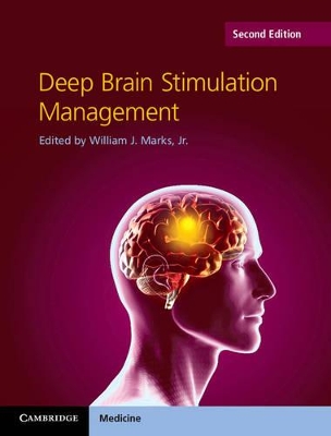 Deep Brain Stimulation Management by William J. Marks, Jr.