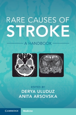 Rare Causes of Stroke: A Handbook book