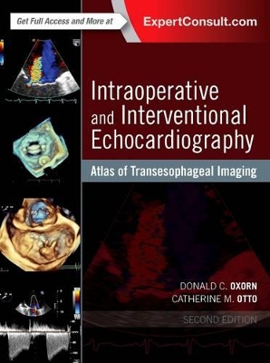 Intraoperative and Interventional Echocardiography book