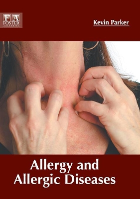 Allergy and Allergic Diseases by Kevin Parker