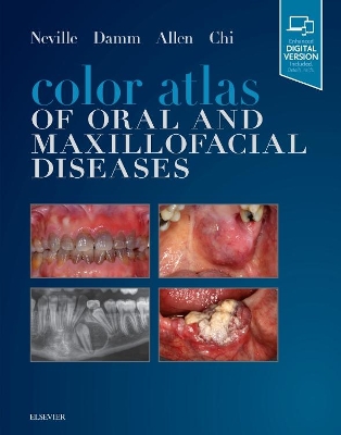 Color Atlas of Oral and Maxillofacial Diseases book