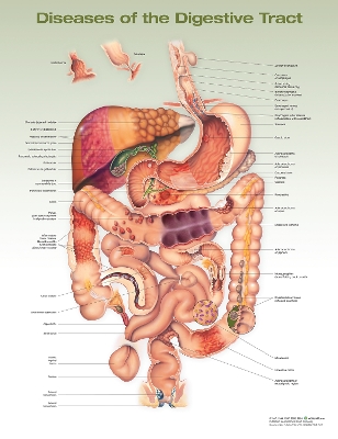 Diseases of the Digestive Tract Anatomical Chart book