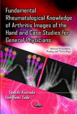 Fundamental Rheumatological Knowledge of Arthritis Images of the Hand & Case Studies for General Physicians book