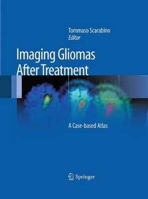 Imaging Gliomas After Treatment book