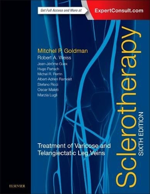 Sclerotherapy book