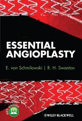 Essential Angioplasty book