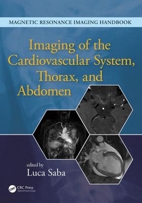 Imaging of the Cardiovascular System, Thorax, and Abdomen by Luca Saba