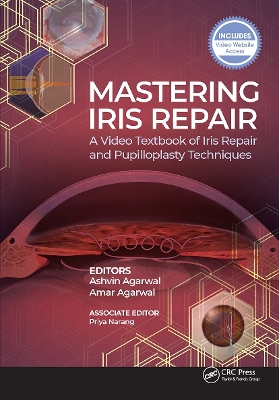 Mastering Iris Repair: A Video Textbook of Iris Repair and Pupilloplasty Techniques book