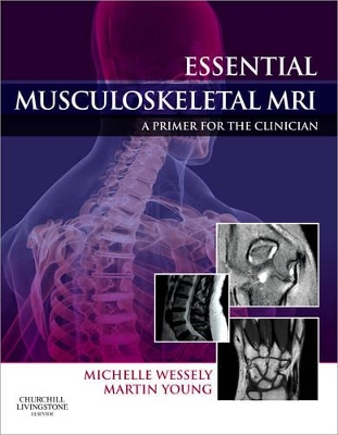 Essential Musculoskeletal MRI book