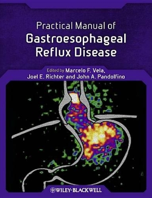 Practical Manual of Gastroesophageal Reflux Disease book
