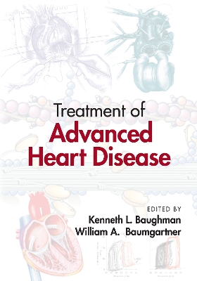 Treatment of Advanced Heart Disease book
