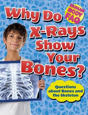 Why Do X-Rays Show Your Bones? book