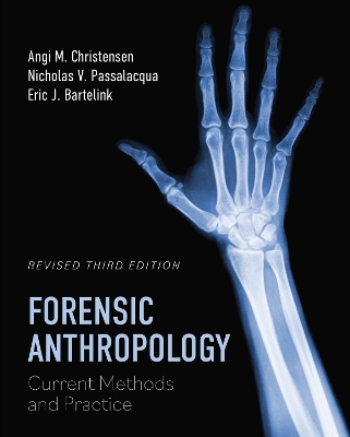 Forensic Anthropology: Current Methods and Practice book