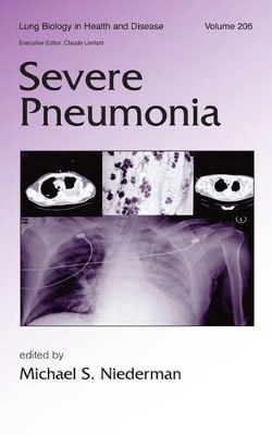 Severe Pneumonia book