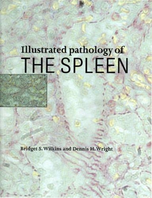 Illustrated Pathology of the Spleen book