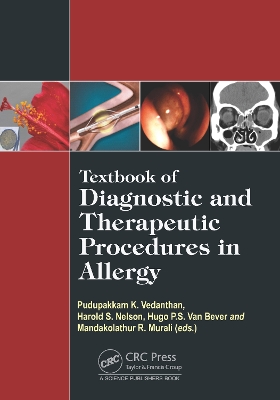 Textbook of Diagnostic and Therapeutic Procedures in Allergy by Pudupakkam K. Vedanthan