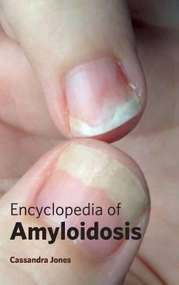 Encyclopedia of Amyloidosis by Cassandra Jones