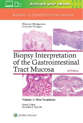 Biopsy Interpretation of the Gastrointestinal Tract Mucosa: Volume 1: Non-Neoplastic by Elizabeth A. Montgomery