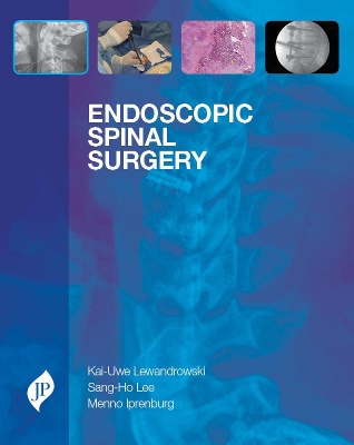 Endoscopic Spinal Surgery book