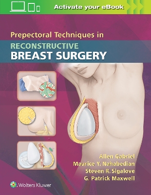 Pre-Pectoral Techniques in Reconstructive Breast Surgery book