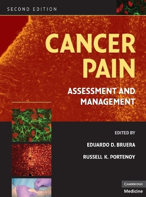 Cancer Pain book
