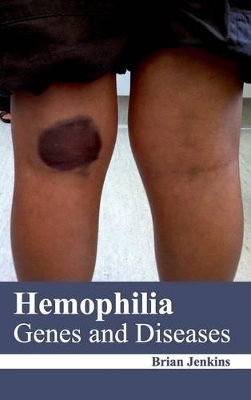 Hemophilia book