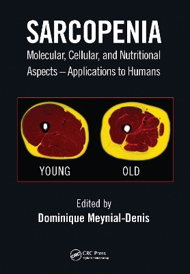 Sarcopenia: Molecular, Cellular, and Nutritional Aspects – Applications to Humans by Dominique Meynial-Denis