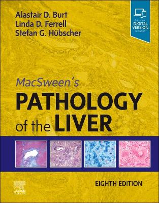 MacSween's Pathology of the Liver by Alastair D. Burt