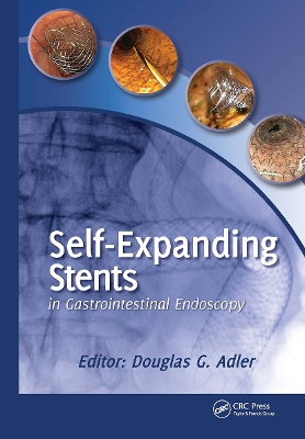 Self-Expanding Stents in Gastrointestinal Endoscopy book