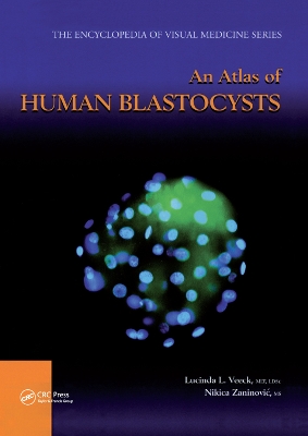 An An Atlas of Human Blastocysts by Lucinda L. Veeck