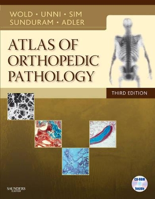 Atlas of Orthopedic Pathology book
