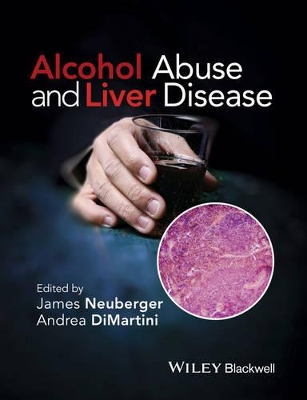 Alcohol Abuse and Liver Disease by James Neuberger
