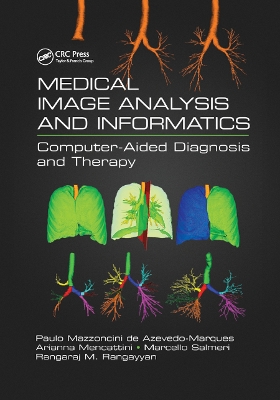 Medical Image Analysis and Informatics: Computer-Aided Diagnosis and Therapy by Paulo Mazzoncini de Azevedo-Marques