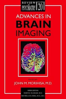 Advances in Brain Imaging book