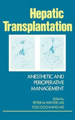 Hepatic Transplantation book