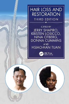 Hair Loss and Restoration by Jerry Shapiro