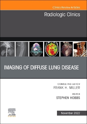Imaging of Diffuse Lung Disease, An Issue of Radiologic Clinics of North America: Volume 60-6 book