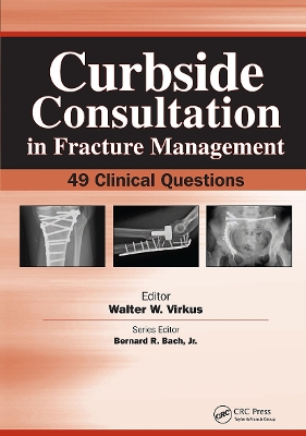 Curbside Consultation in Fracture Management book