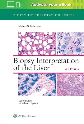 Biopsy Interpretation of the Liver by Michael Torbenson