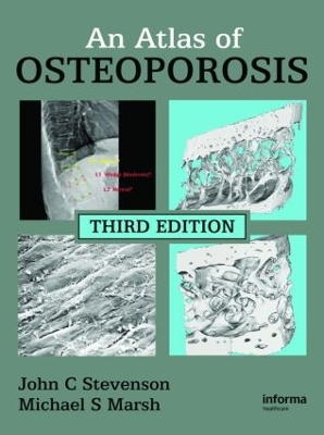 Atlas of Osteoporosis by John C. Stevenson