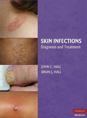 Skin Infections book