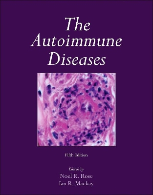 Autoimmune Diseases book